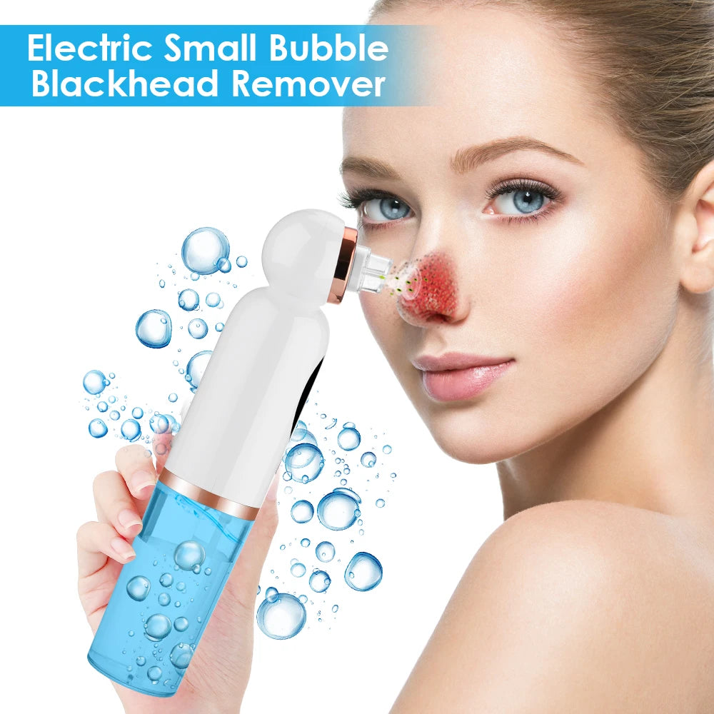 Blackhead Remover with Suction Technology